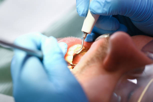 Best Tooth Pain Emergency Relief  in Martins Ferry, OH